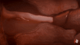 69a19e2ca24916.72145144.gif